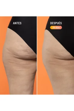 Beta-Burner tratamiento reafirmante